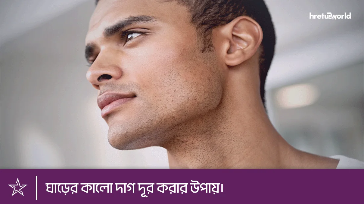 Ways to remove dark spots on the neck